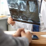 How Long to Seek Treatment After Falls How Long to Seek Treatment After Falls