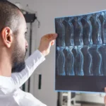 Next Steps for Spinal Cord Injuries Next Steps for Spinal Cord Injuries